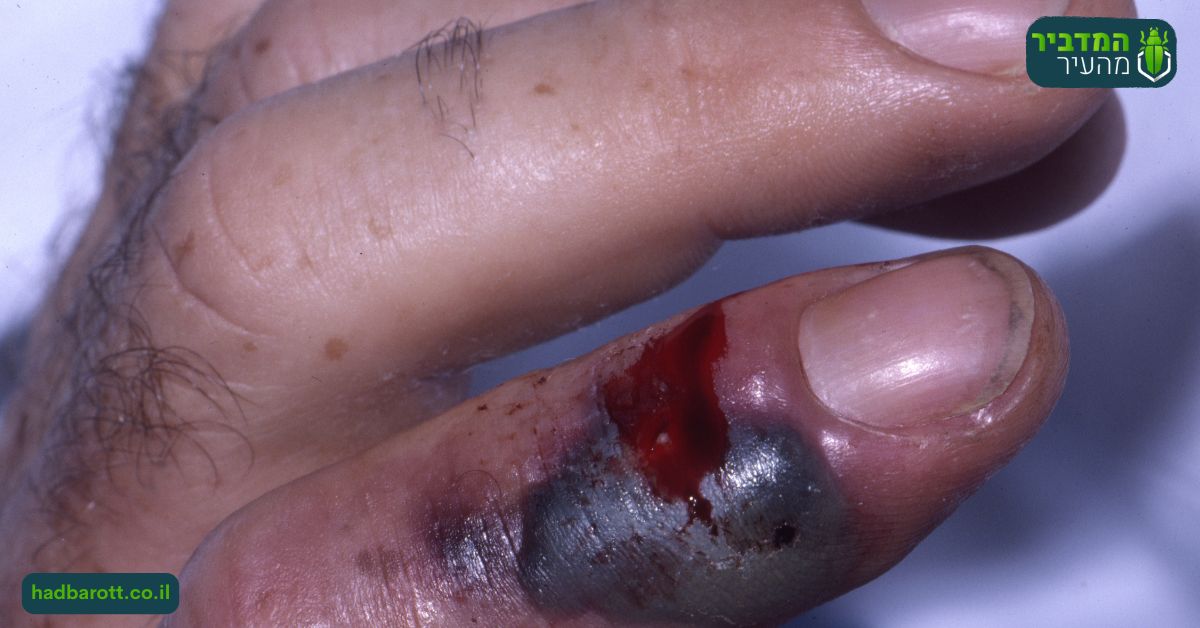 הכשת נחש